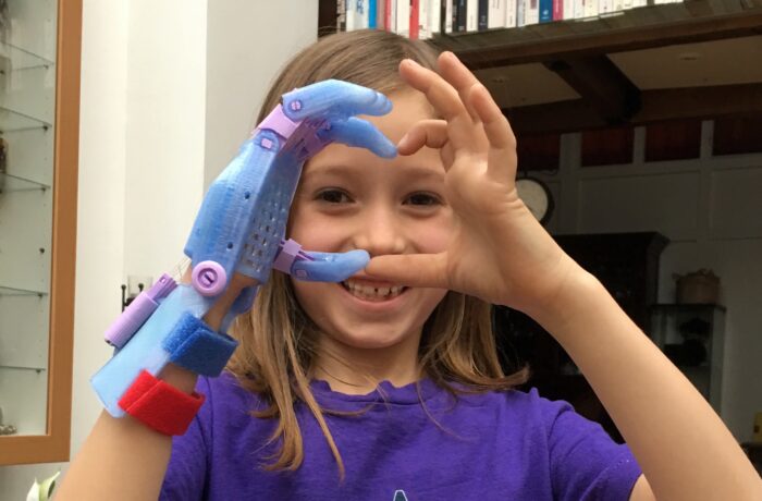 Petite fille faisant un coeur avec sa prothèse main 3D e-Nable